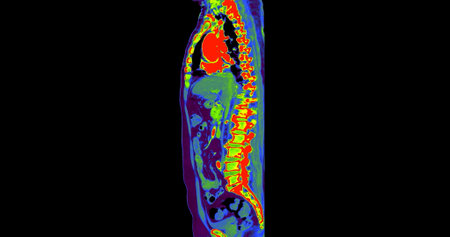 CT Chest and Abdomen with injection contrast media sagittal plane for diagnosis chest and  abdominal pain.の写真素材