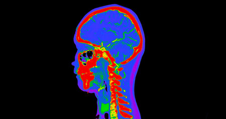 CT angiography of the brain or CTA brain and neck Sagittal view 3D Rendering image fusion color mode . medical technology concept.の写真素材