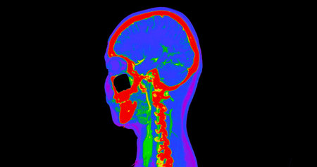 CT angiography of the brain or CTA brain and neck Sagittal view 3D Rendering image fusion color mode . medical technology concept.の写真素材