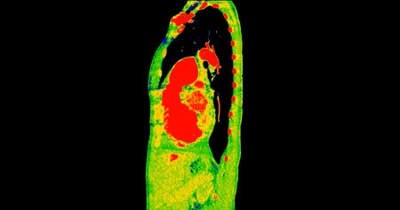 CT scan of Chest sagittal view in color mode  for diagnostic Pulmonary embolism (PE) , lung cancer and covid-19.の写真素材