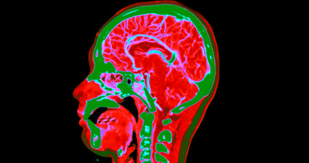 CT angiography of the brain or CTA brain and neck Sagittal view 3D Rendering image fusion color mode . medical technology concept.の写真素材