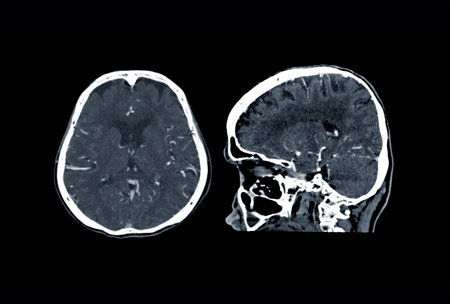 CT scan of the brain Axial , sagittal plane for diagnosis brain tumor,stroke diseases and vascular diseases.の写真素材
