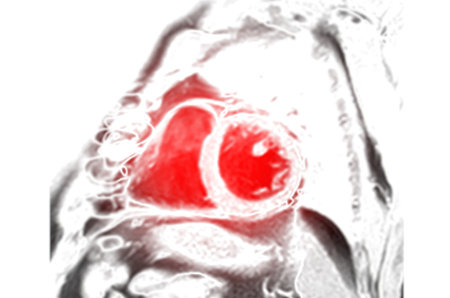 MRI heart or Cardiac MRI ( magnetic resonance imaging ) of heart Short axis view for diagnosis heart disease.の写真素材