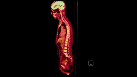 PET CT image of Whole human body   sagittal plane. Positron Emission Computed Tomography .の写真素材