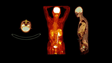 PET CT image of Whole human body  Axial ,coronal and sagittal plane. Positron Emission Computed Tomography .の写真素材