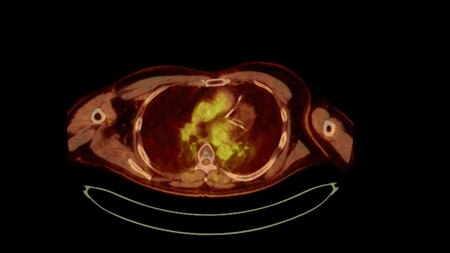 PET CT image of Whole human body  Axial  plane. Positron Emission Computed Tomography .の写真素材