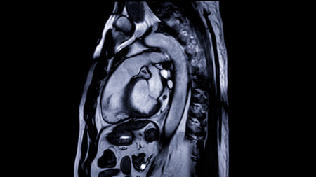 MRI heart or Cardiac MRI ( magnetic resonance imaging ) of heart  for detecting heart disease.の写真素材