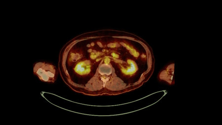 PET CT image of Whole human body  Axial  plane. Positron Emission Computed Tomography .の写真素材
