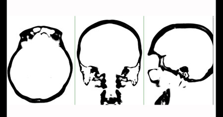 CT scan of the brain axial,coronal and sagittal view  black and white mode.の写真素材