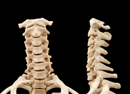 CT scan of C-Spine or Cervical spine 3D rendering  for diagnosis  fracture of cervical spine in  trauma case.の写真素材