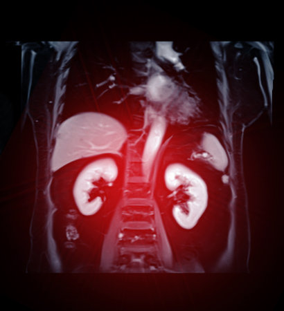 MRI of the upper abdomen coronal view is a non-invasive imaging technique providing detailed visuals of organs like the liver, pancreas, and kidneys.の写真素材