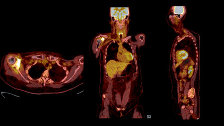 PET CT Scan fusion image It provides detailed images by merging metabolic activity from PET with anatomical information from CT scans.の写真素材