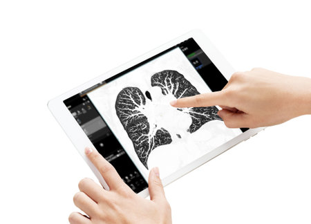 Hand Touching Tablet Display of CT Chest Scan shown on a tablet screen, with a hand pointing to the clear lung structures, emphasizing modern imaging, isolation on white background, clipping path.の写真素材
