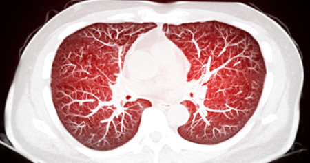 CT Chest Scan Overview  shows clear lung fields, heart, and mediastinum, providing a detailed view of the thoracic anatomy for medical evaluation.の写真素材