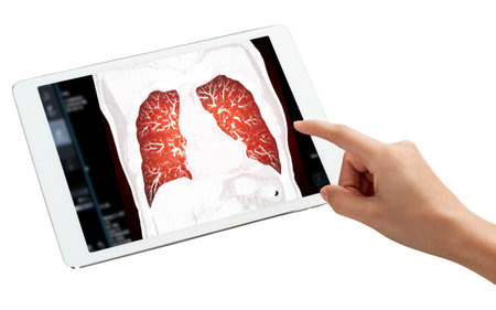 Hand Touching Tablet Display of CT Chest Scan shown on a tablet screen, with a hand pointing to the clear lung structures, emphasizing modern imaging, isolation on white background, clipping path.の写真素材