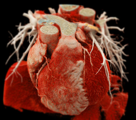 Realistic Coronary Artery CTA:
The image features a 3D coronary artery CTA scan, highlighting the heart's structure and vascular pathways for diagnosing heart disease.の写真素材