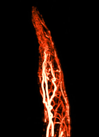 Hand Vascular Imaging via MRA:
The MRA scan captures the detailed arterial structure of the hand, providing high-resolution imaging of blood flow pathways.の写真素材