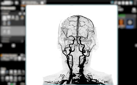 CTA Brain Imaging  shows a 3D brain CTA scan displayed on a tablet, with hands interacting for detailed vascular and neurological evaluation, isolation on white background, clipping path.の写真素材