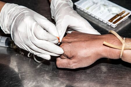 hands of quack doctor use syringe injections to the patient hand in the illegal beauty clinic.の写真素材
