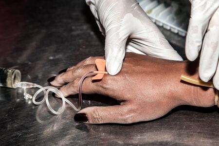 hands of quack doctor use syringe injections to the patient hand in the illegal beauty clinic.の写真素材