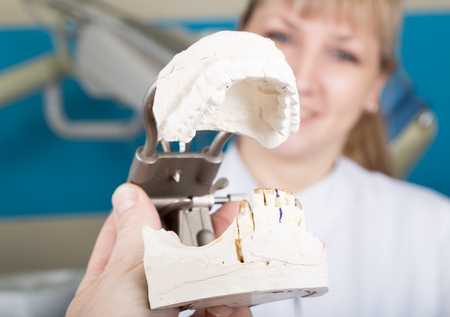 The reception was at the female dentist. dentist holding a dental casts