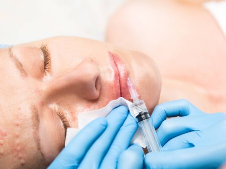 Beautician makes biorevitalization to young woman. The cosmetic procedures for the face. Beauty...
