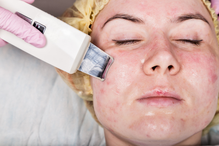 beautician at work. Ultrasonic face cleaning procedure for problem skin. Pore cleansing, oxygen saturation for womans faceの写真素材
