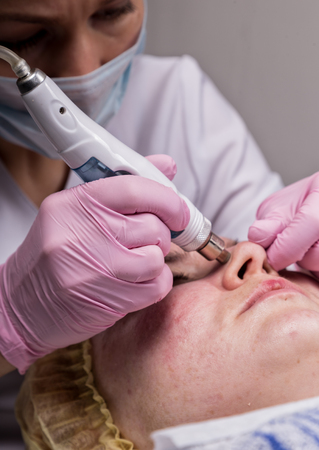 young woman with problem skin, mechanical deep face cleaning. beautician cleanses the womans skin with cosmetic equipmentの写真素材