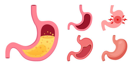 Gerd stomach icon set collection in flat style. Reflux vector illustration on isolated background. Esophageal organ sign business concept.のイラスト素材
