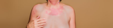 Woman experiencing skin rash and irritation from immune deficiencyの写真素材