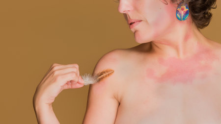 Woman embracing unique beauty despite skin conditionの写真素材