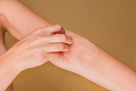 Woman scratching arm with rash and irritationの写真素材