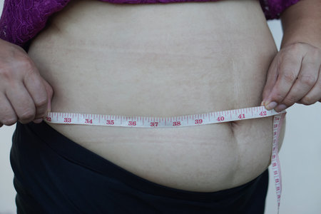 Closeup woman hands measure her big belly, fat with cellulite abdomen by using measuring tape....