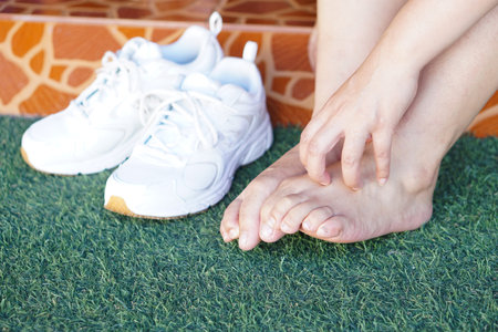 Close up woman hand is scratching her itchy feet. Concept, health problems, skin allergy, rashes,...