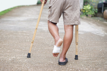 Close up man walking with wooden crutches because of injury on foot. Concept, Medical equipment for helping disabled people or patients with symptom of walking problems.の写真素材