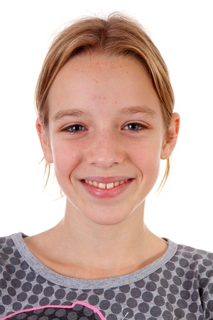 Portait of teenage girl with pimpels over white backgroundの写真素材