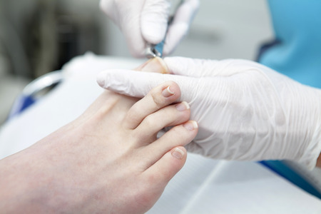 Cutting toe nails bij pedicure in closeupの写真素材