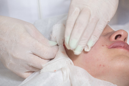Photo of cosmetic procedures . Cosmetic injections .の写真素材