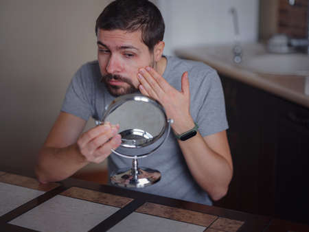 guy checking his skin. Young man looking in mirror touches face with pimple feels disgruntled. Anti-acne skincare treatment, hormonal imbalance, stress, diet, skin problem, freckle appearance conceptの写真素材