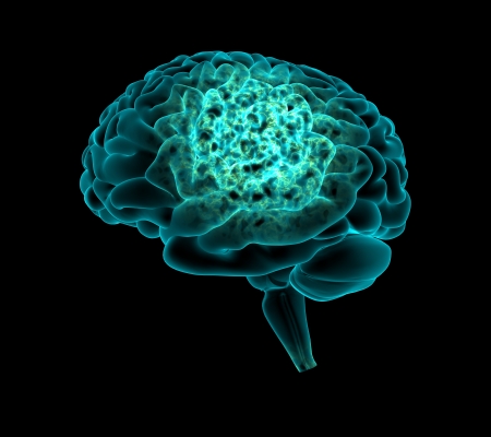 Brain workingの写真素材