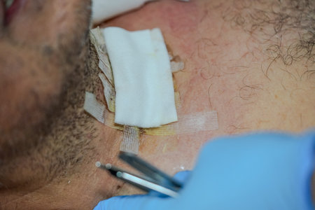 Surgeon performing an operation on a man's shoulder, close-up