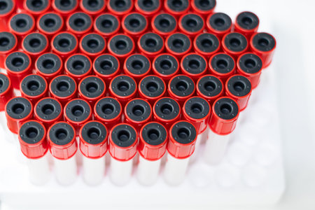 Blood tube for testing in laboratory in hospital