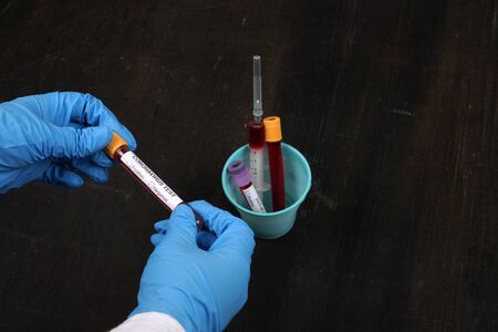 Doctor holding coronavirus blood tube in hand on black backgroundの写真素材