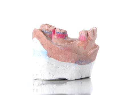 Denture mold,broken tooth placed on white background.の写真素材