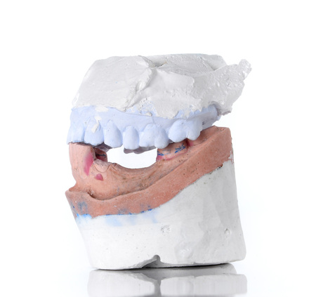 Top and Bottom denture mold,broken tooth placed on white background.の写真素材