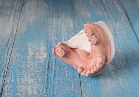 Denture mold,broken tooth placed on wooden floor.の写真素材
