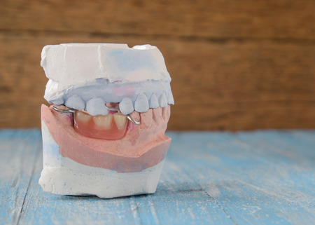 Top and Bottom denture mold,false teeth placed on wooden floor.の写真素材