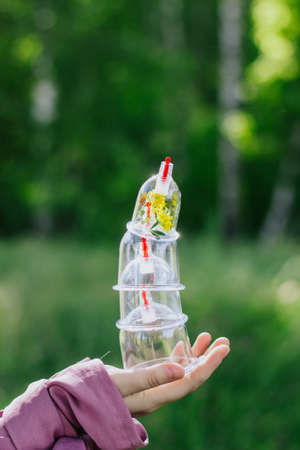 The girl holds a jar for a hijama and a flower in her hands. Yellow flowers. Hijama, bloodletting,...