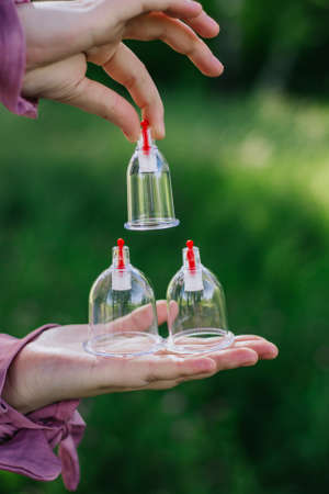 The girl is holding a jar for hijama. Hijama, bloodletting, treatment of sunna. Jars for bloodletting against the background of trees and greenery.の写真素材
