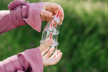 The girl is holding a jar for hijama. Hijama, bloodletting, treatment of sunna. Jars for bloodletting against the background of trees and greenery.の写真素材